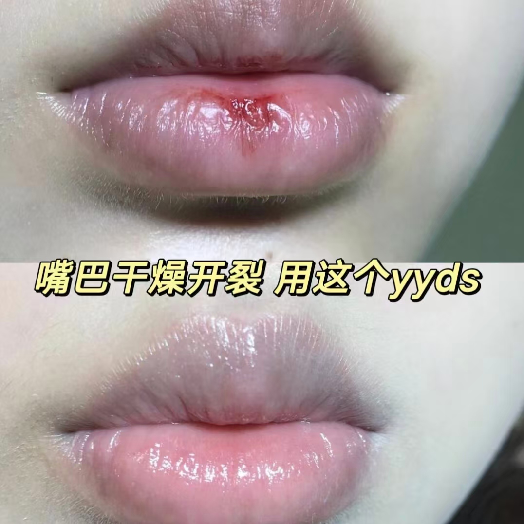 绿力马油唇部抑菌膏2支 9.9元 - 86线报 绿力马油唇部抑菌膏2支 9.9元 - 86线报