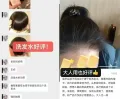 bodcrme/贝德美 儿童洗发水 0-15岁 控油去屑 蓬松 图片 2