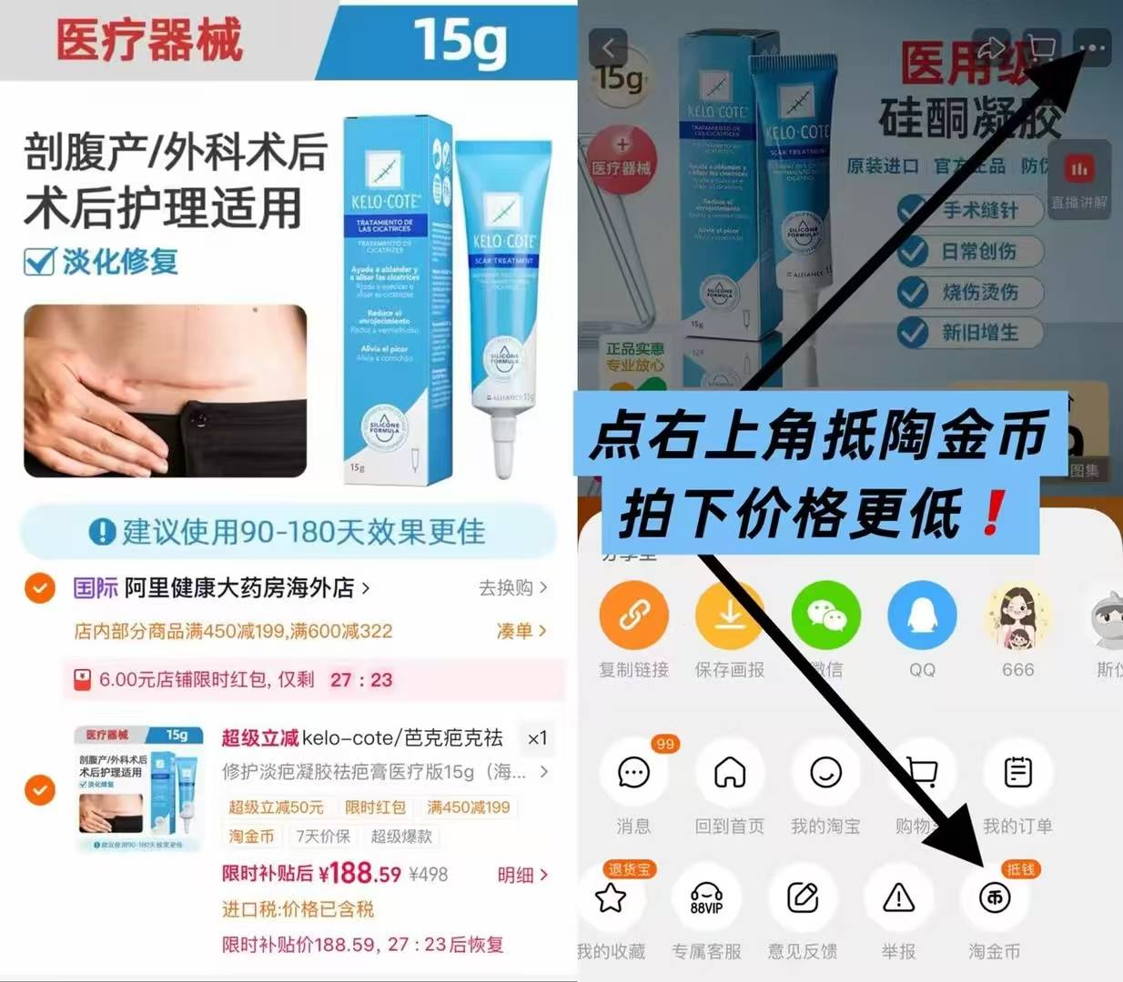 疤克修复医用凝胶祛疤膏15g 188元 - 86线报 疤克修复医用凝胶祛疤膏15g 188元 - 86线报