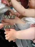 Plants Mom/植物妈妈 紫草膏婴儿儿童蚊虫叮咬止痒消肿膏 图片 1