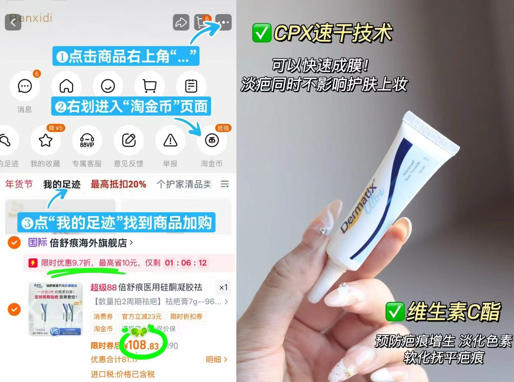 Dermatix倍舒痕祛疤膏7g/支 108.8元 - 86线报