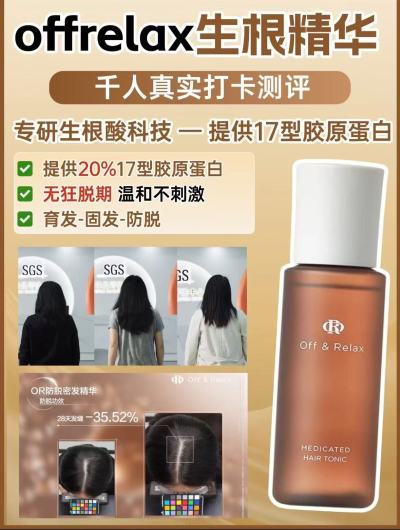 速‼️𝗼𝗳𝗳𝗥𝗲𝗹𝗮𝘅防脱育发液100ml - 86线报