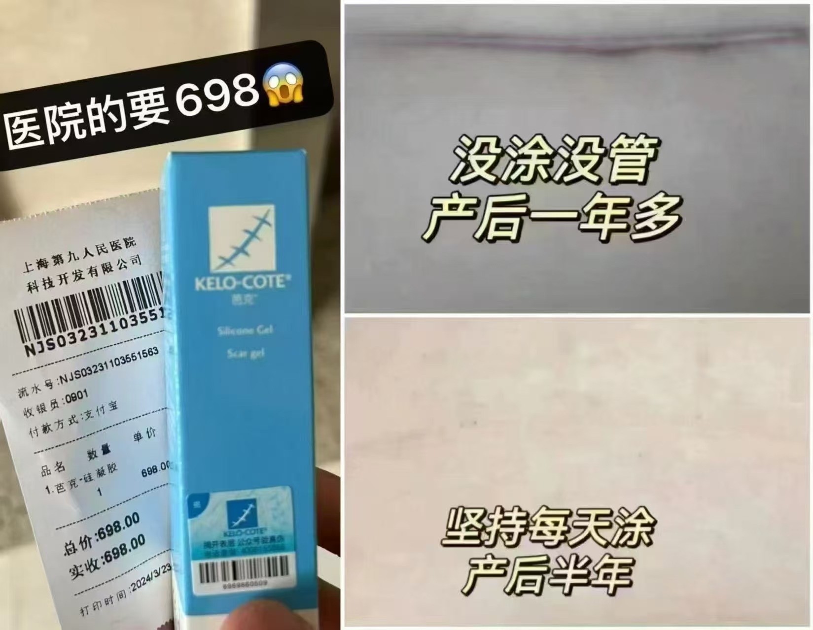 ♥️KeloCote芭克祛疤膏🔥 💰122🉐6.5g‼含贈❗️ 🔹需入荟 - 86线报