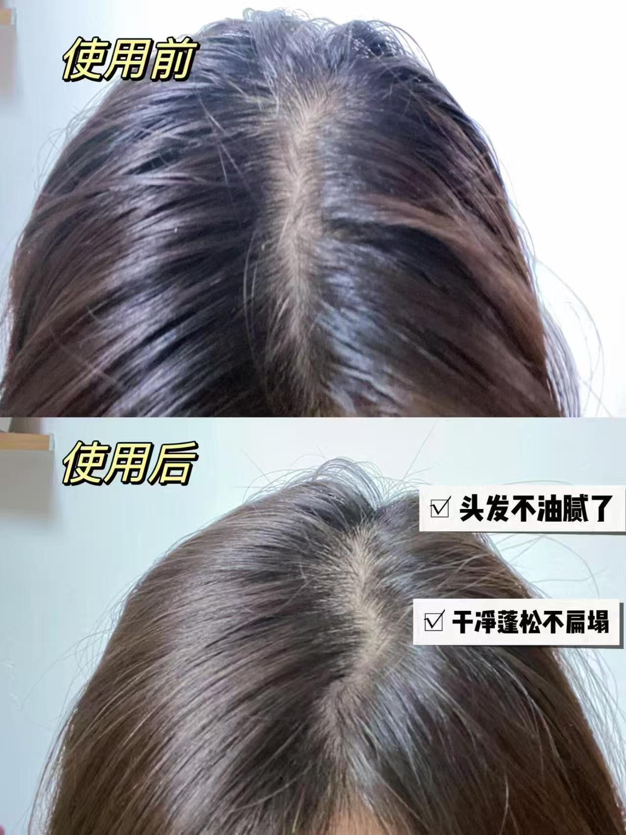 滋源无患子洗发水735ml 25.9元 - 线报酷