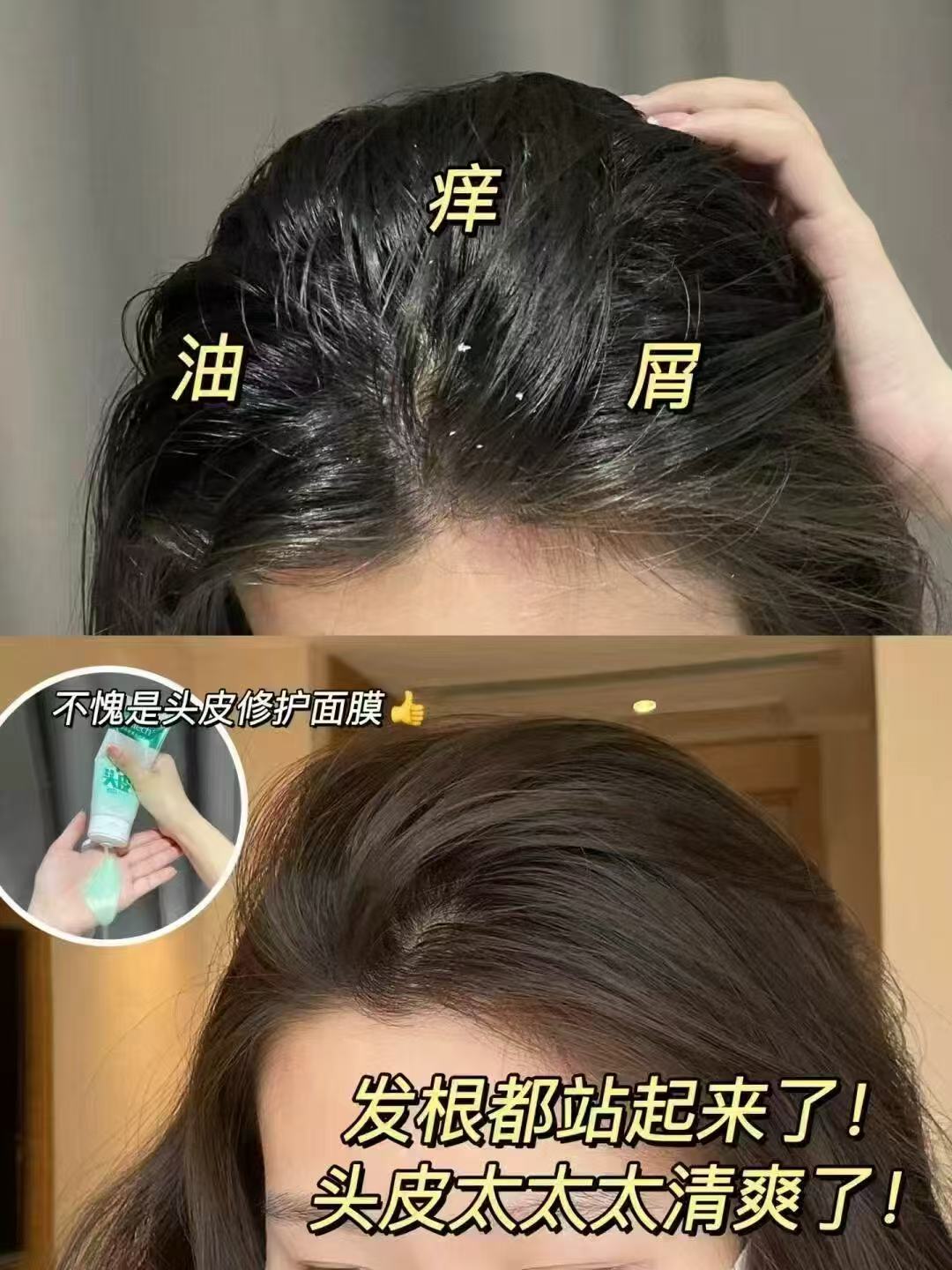 科丽尼青蒿头皮素袋装30ml 16.9元 - 86线报