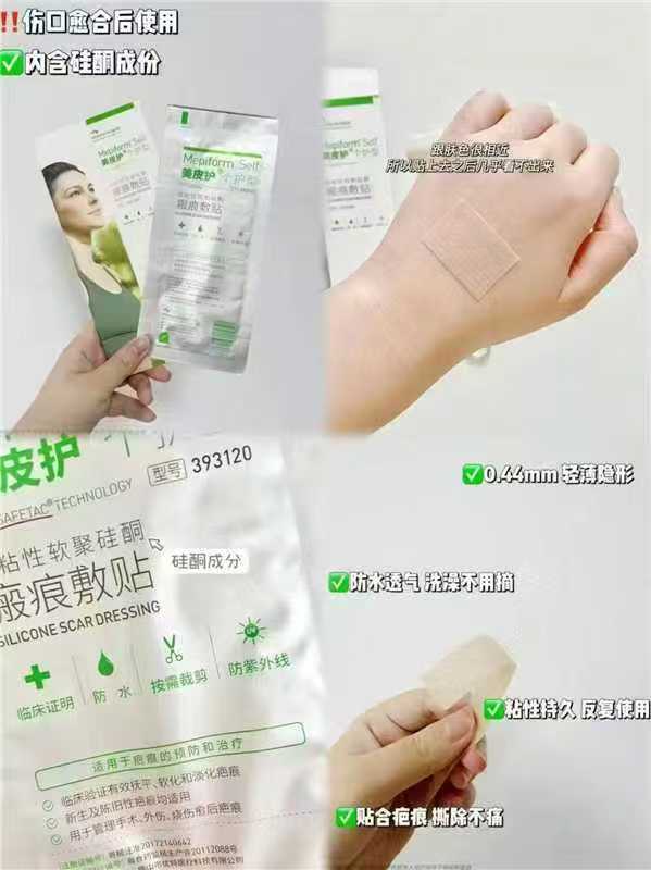 美皮护Mepiform疤痕贴5×7.5cm拍3件 185.1元 - 线报酷