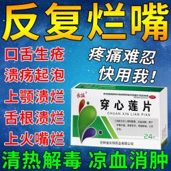 长恒口腔溃疡专用药口舌生疮药嘴巴上火起泡舌头溃疡口疮中药穿心莲片 4.5元 - 86线报