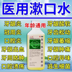 金口馨复方氯己定含漱液150ml1盒装 15.5元 - 86线报