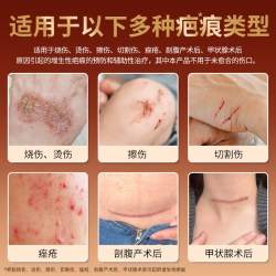 芭愈沙漠极境医用依克多因硅凝胶预防辅助治疗剖腹产术后疤痕膏 10元 - 折送网